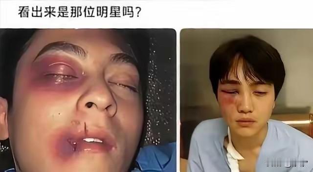 某明星在酒吧强搂别人的女朋友，结果却被对方男友一顿暴揍，没想明星第一句喊的居然是