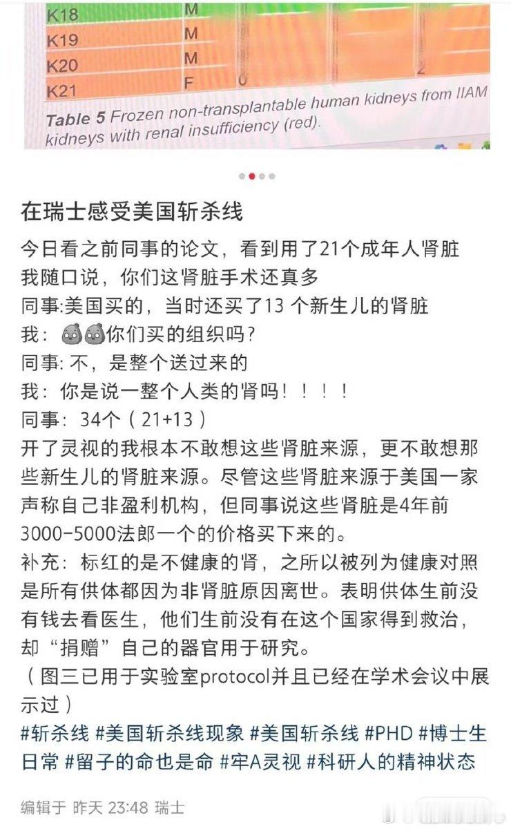 斩杀线烽火问鼎计划“从美国买了13个新生儿的肾脏。”“你是说买的肾脏组织吗？”