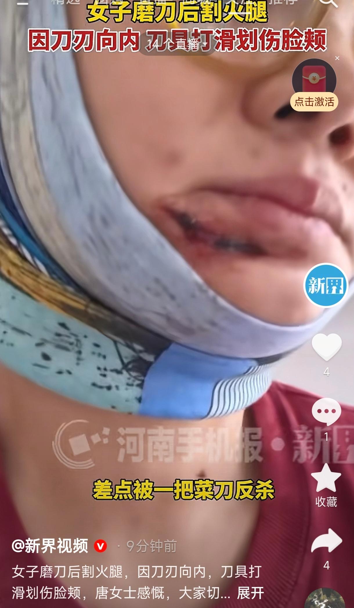 太吓人了！北京，一女子为了切一块火腿，特意把菜刀磨得飞快，结果切的时候姿势不对，