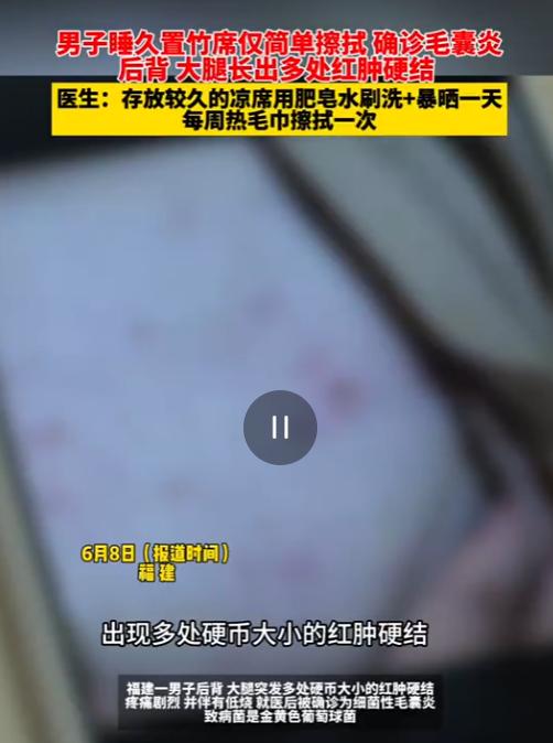 “真是太大意了！”据6月8日消息，福建一名男子因天气炎热，找出家中存放