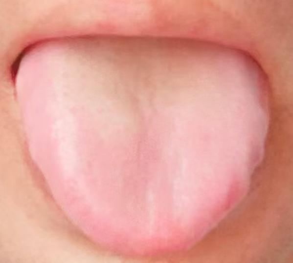 阴阳两虚气血不畅，循序渐进调养身体状态很多人的海绵体一旦出现了问题