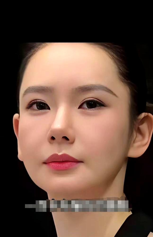 戚薇又上热搜了。这次不是秀恩爱，是脸僵成馒头，眉毛动不了。她直播掀刘海：