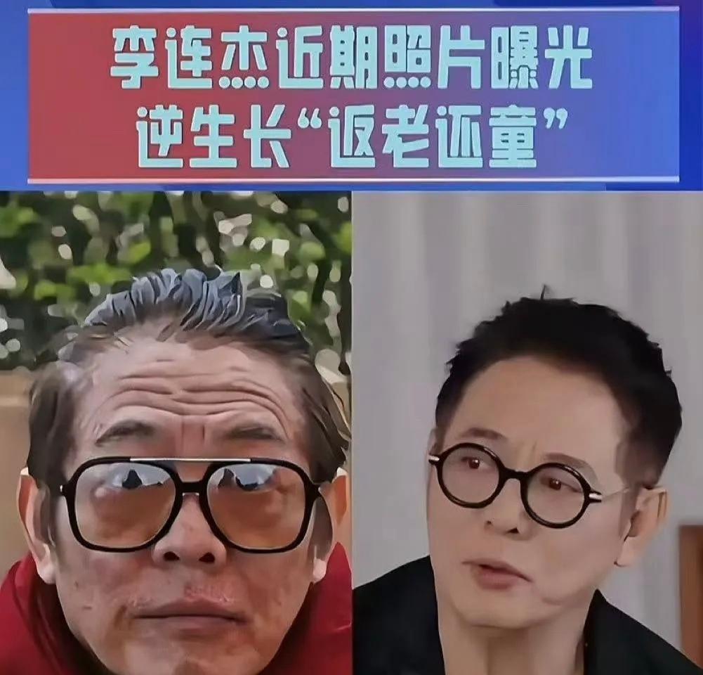 某天，李连杰照镜子的时候，发现脖子上长了一个肿块，以为是炎症，就没在意。吃了一段