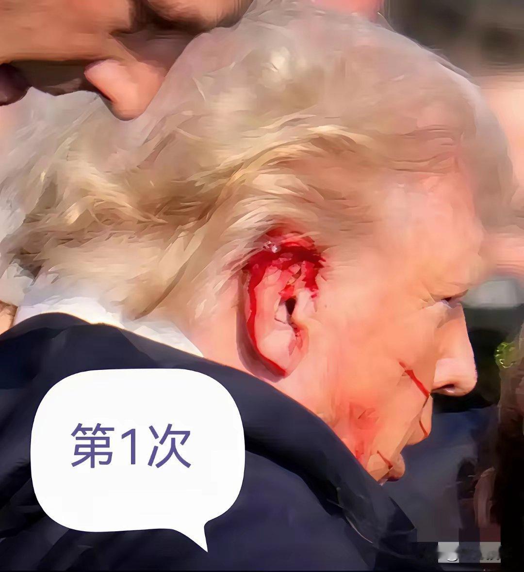 老特真的福大命大！2次都平安渡劫！