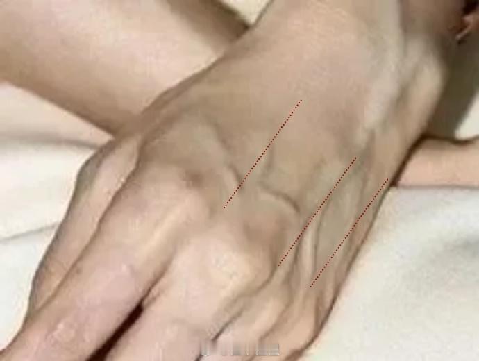 手背青筋明显，它并不是使劲握拳后出现或者特别瘦，手如干姜衬托出来的血管怒张青筋明