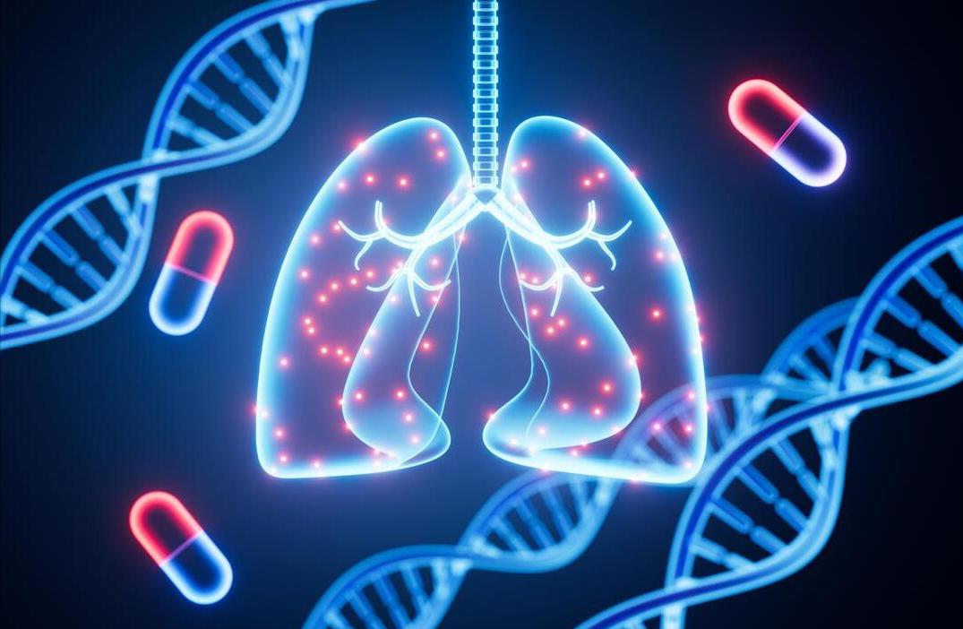 支气管扩张患者最害怕的细菌，是结核菌的小兄弟，治疗起来很麻烦昨天上门诊遇到一位