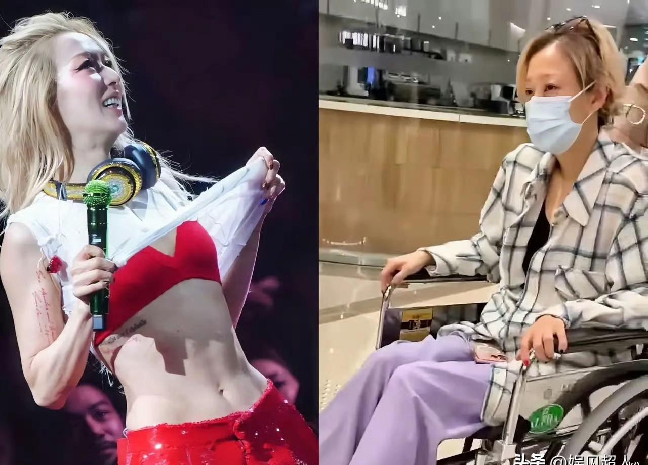 轮椅推出来那天，铜锣湾粉丝吓一跳：郑秀文168的骨架缩成一把干柴，腰上两块腰椎撕