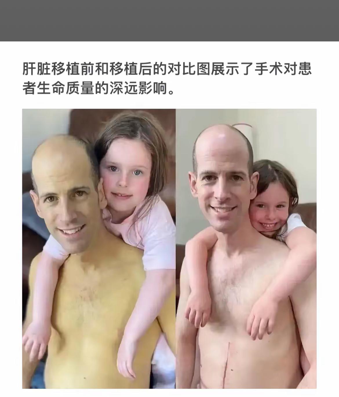 手术前后的对比，生命焕然一新。