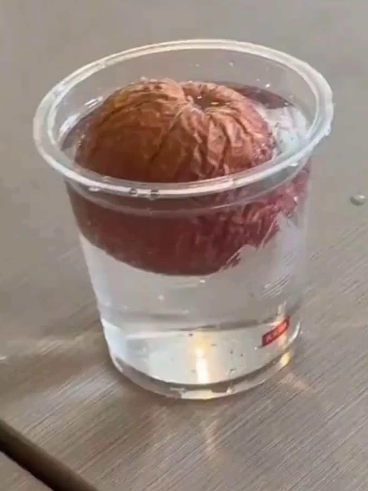 浙江的金阿姨，节俭过了一辈子，就因为舍不得扔掉两个皱皮苹果，连着两天吃下去之后开