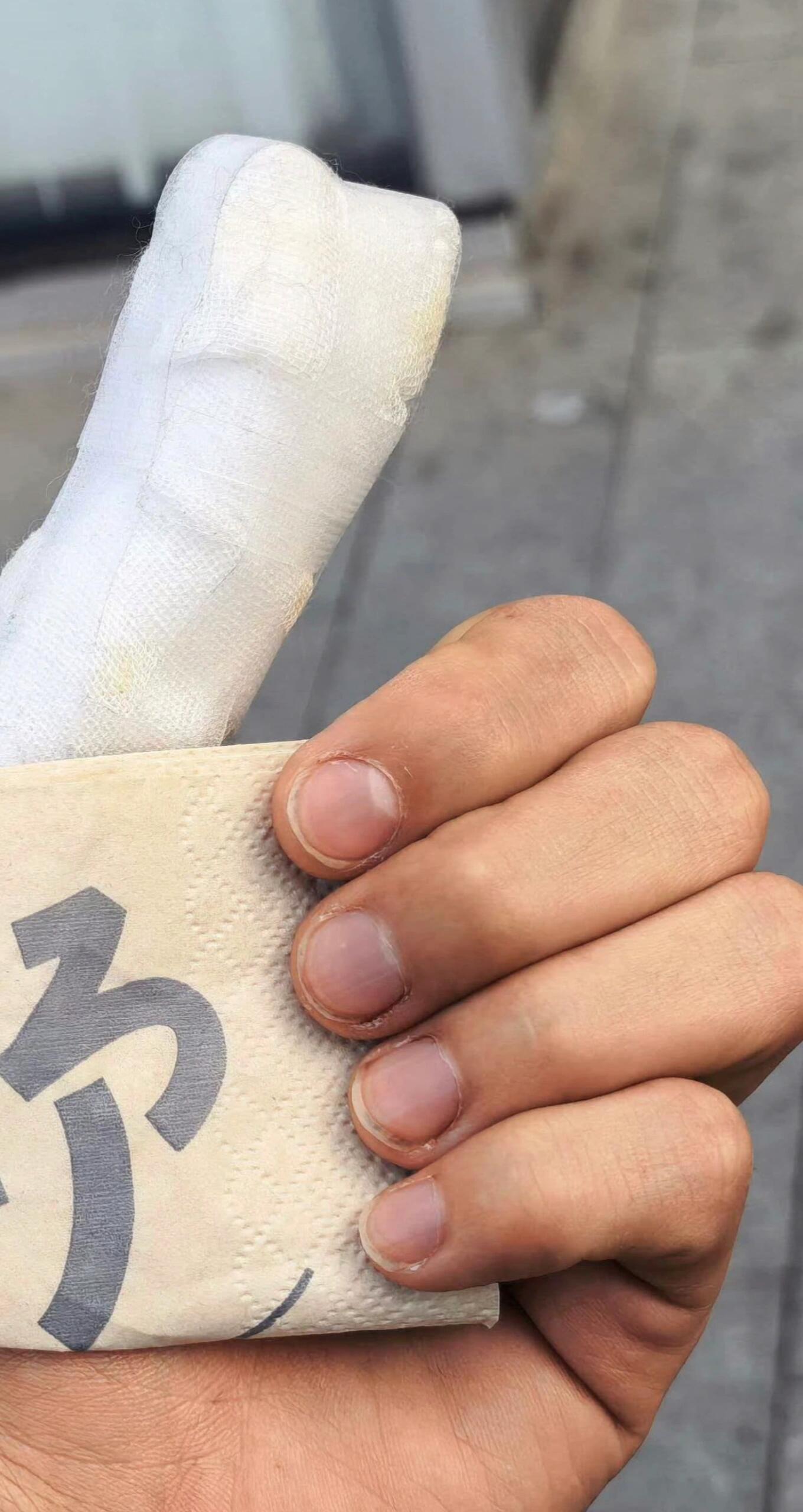 都这样了还哄我们开心可是我好像看到了其他手指甲边也有点红红的十个勤天|种