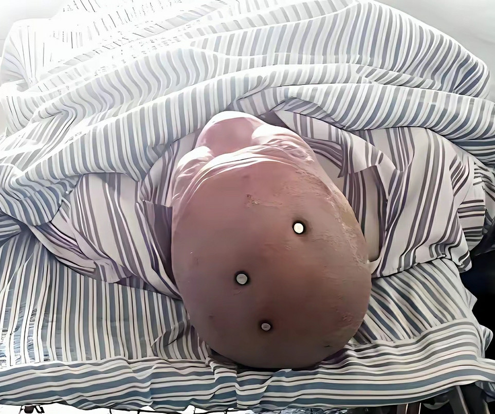 我的天呐这三个钉子怎么扎进去的呀看着好疼啊