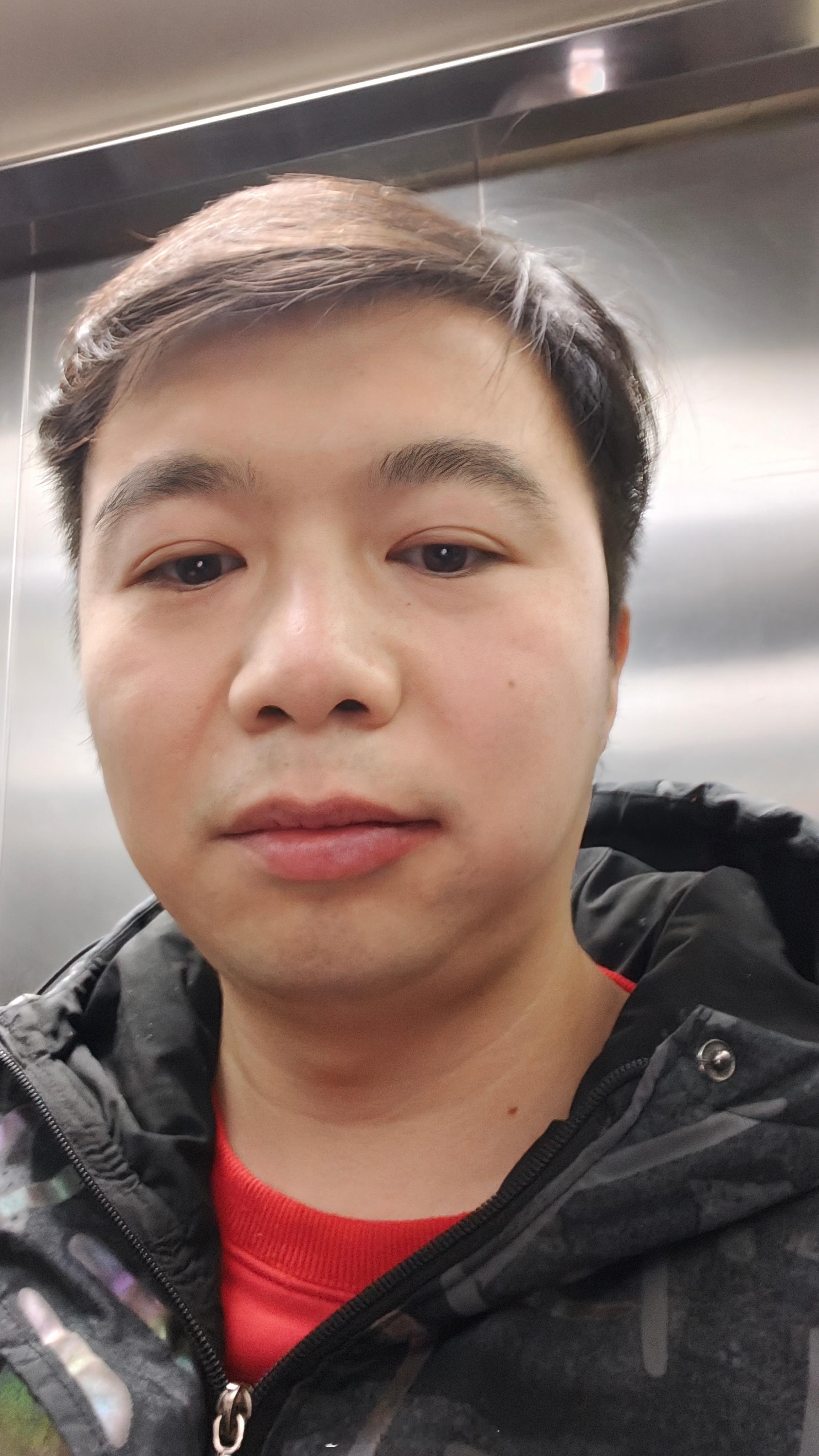 我的一个坏牙上午诊断了之后说10分钟搞定那时候快到中午了医生说拔牙2小时不能吃喝