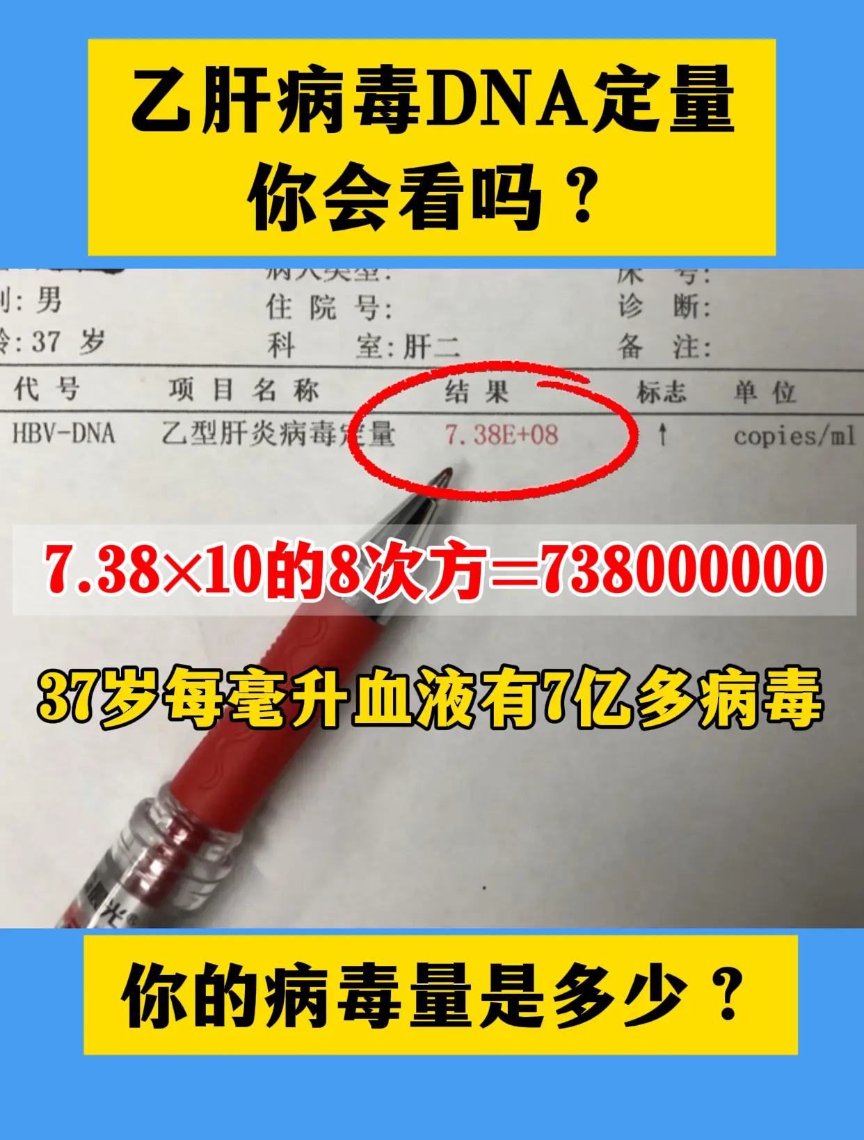 乙肝 病毒量 健康科普 肝硬化 肝病教授陈士俊