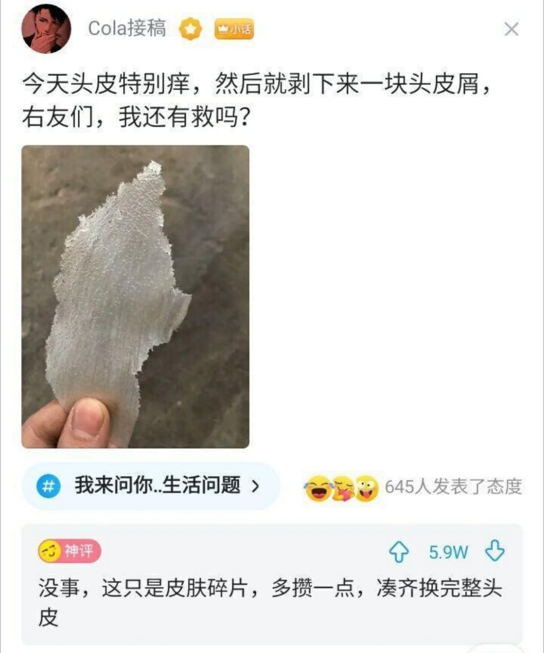 救命！本来只是头皮痒想抓两下