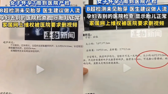 “到底听谁的？今年8月，山东一女子怀孕七周去做产检，却被告知“未见胎芽”医生建议