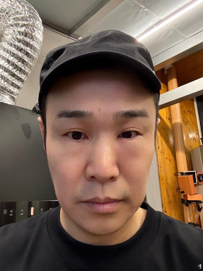 10月3日中午小沈阳在个人社交平台上晒自拍照，眼睛肿得像蜜蜂蛰了似的，没想老婆沈春阳和女儿沈佳润带头