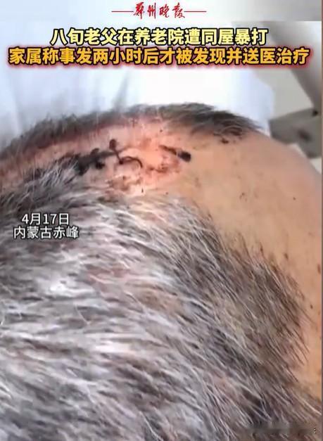 内蒙古赤峰，女子将丈夫送到养老院，几天后接丈夫，只见丈夫裤子直接裂开到裤裆，上衣