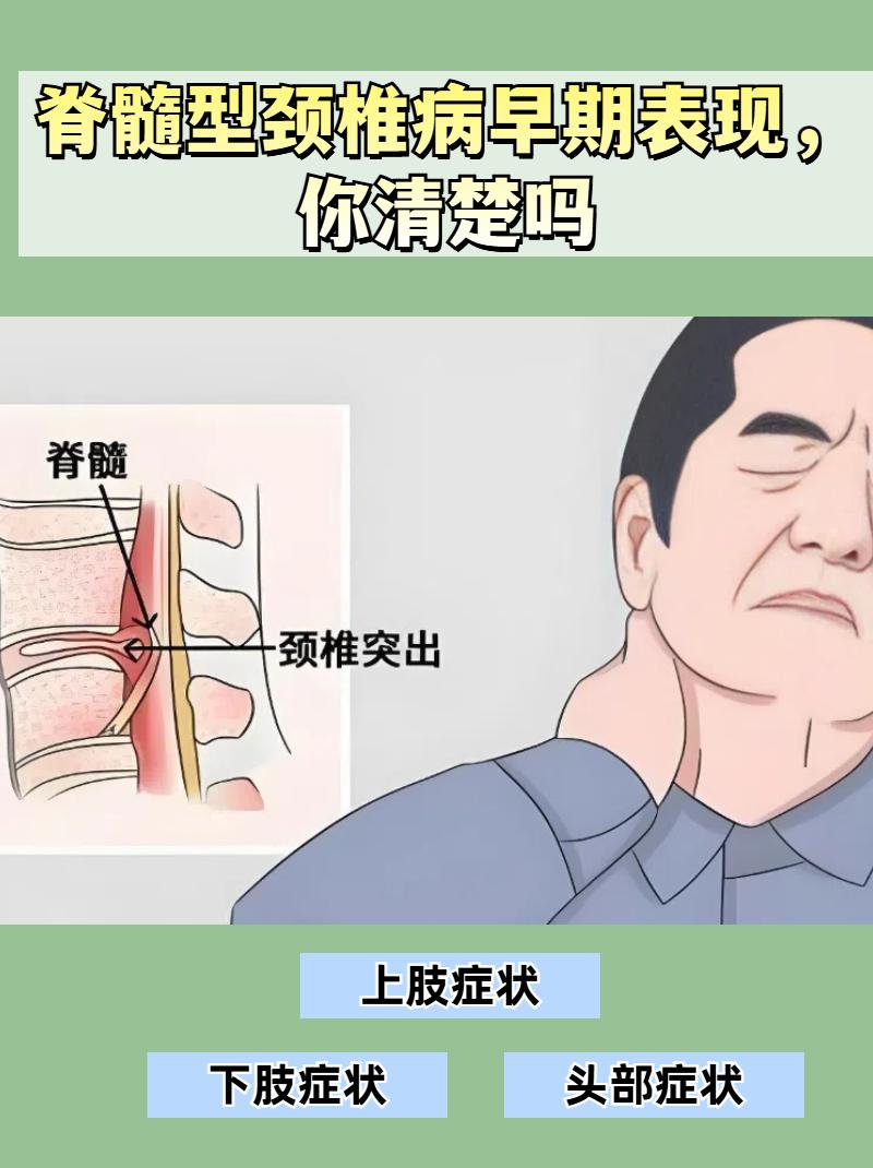 颈椎病保守治疗两个多月，竟从神经根型转成了脊髓型，病情愈发严重，我真是服了！