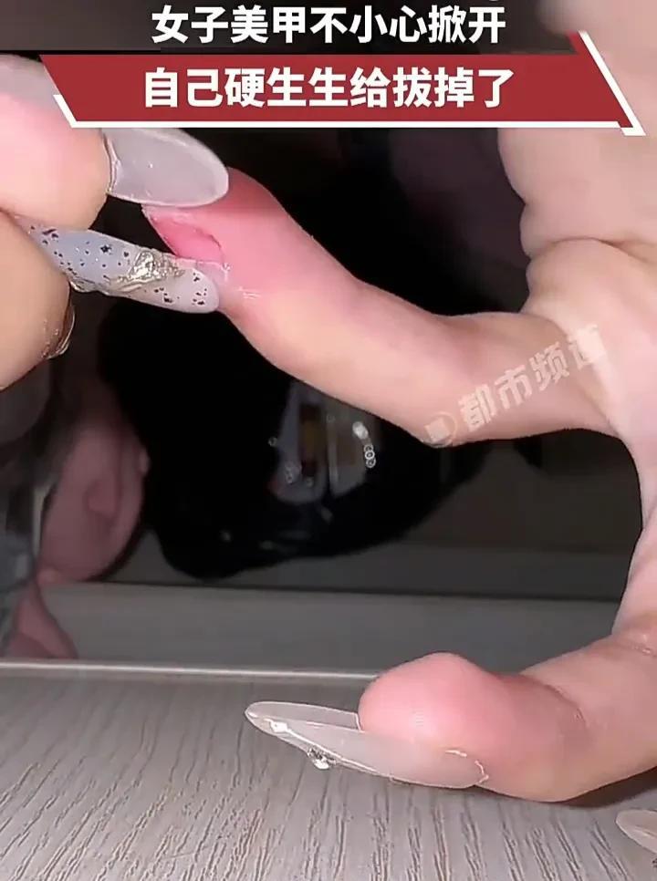 隔着屏幕都感觉疼！5月6日，广东一名女子发视频称，自己做了长美甲，结果不慎发生意