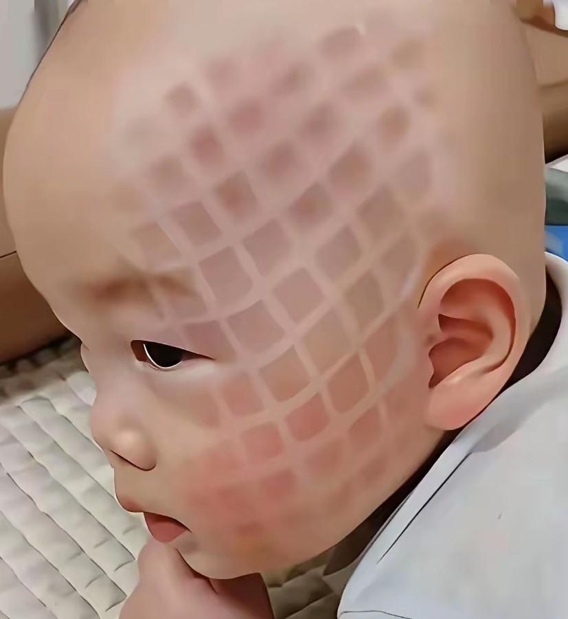 这个床垫子不适合小孩在上面睡觉，由于孩子的皮肤太嫩，床垫子上的纹路完全印在了孩子