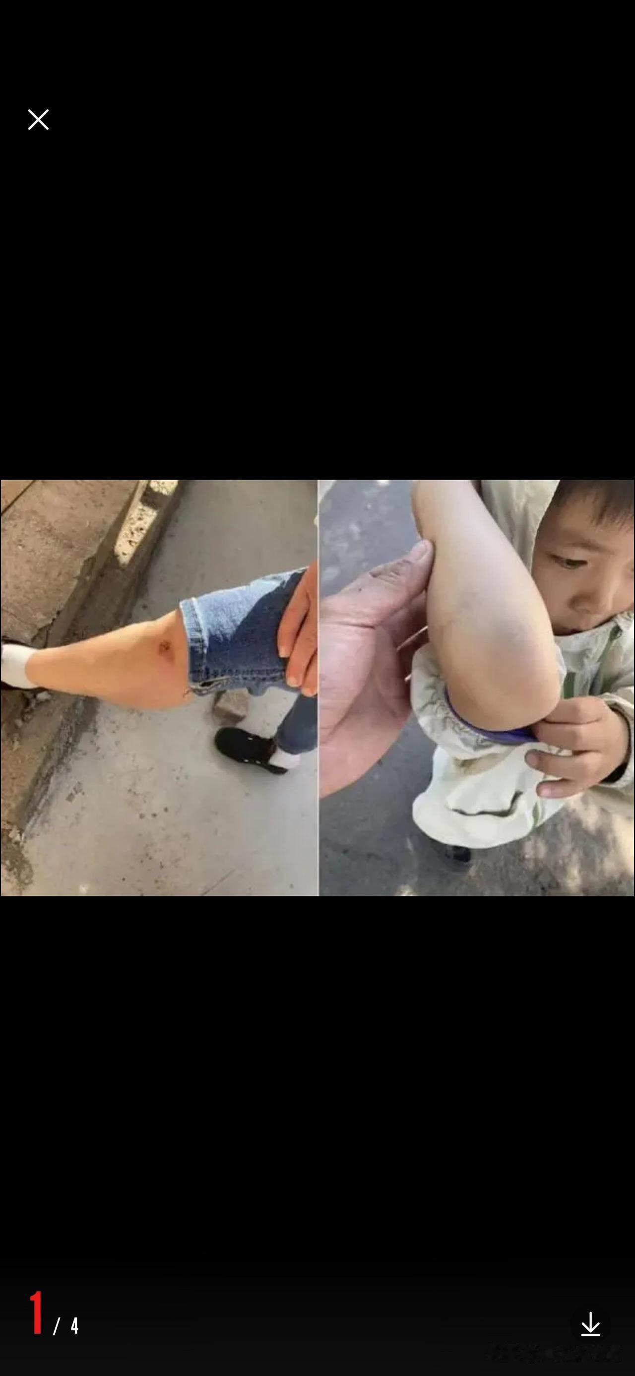 58岁奶奶骑一台新电动车接孙子，用NFC解锁车子，没跑两步方向把锁死，跌破膝