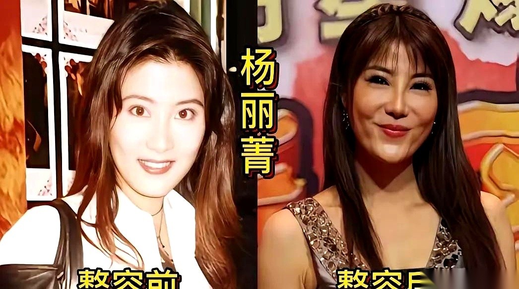 张萌被网友反复盯着面部变化议论，她本人却从未承认过整容。她是环球小姐出身，早年凭《神话》里的小月惊艳