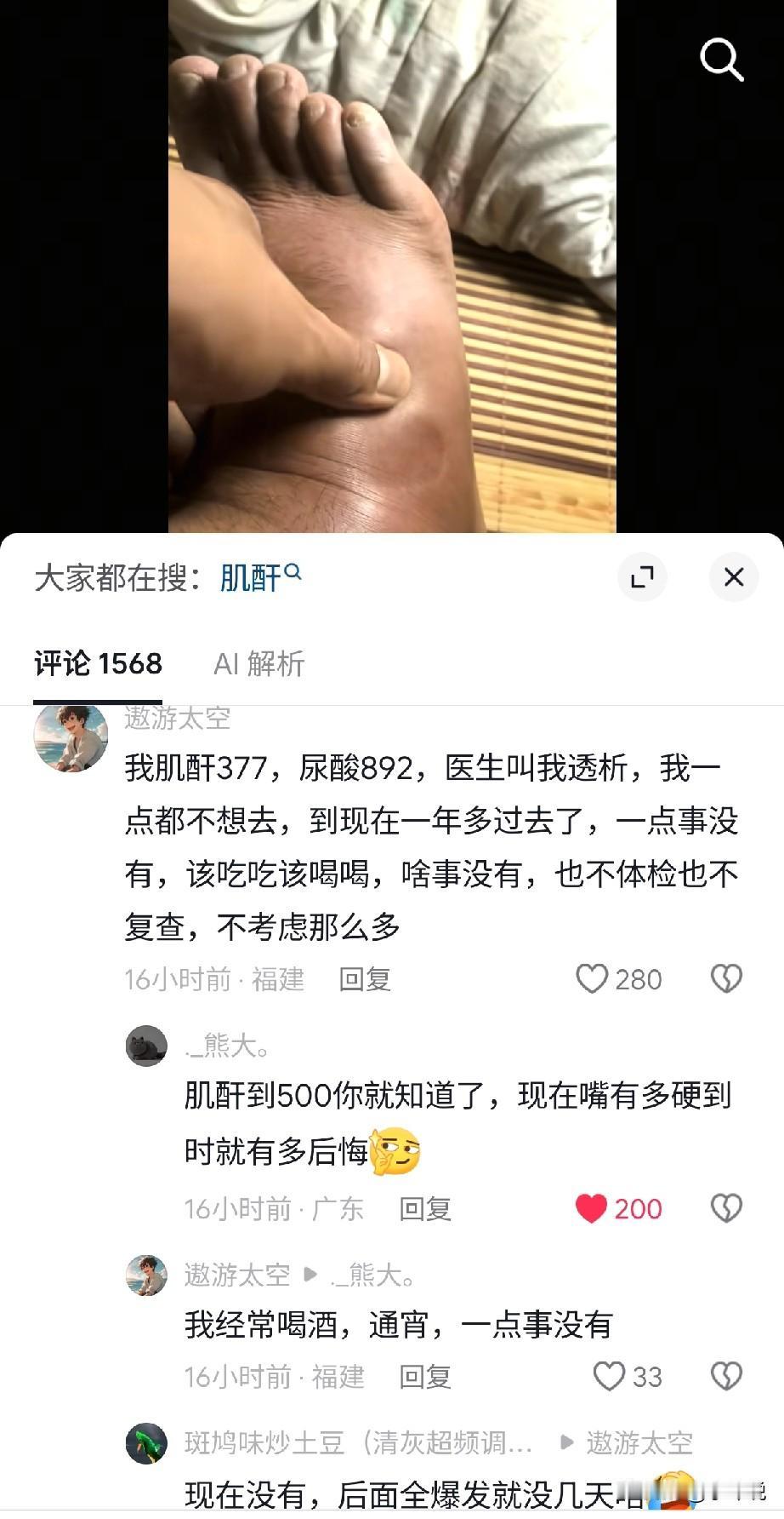 一个网友说他肌酐377，尿酸892，医生叫他去透析，他一点都不想去，距离医生叫他