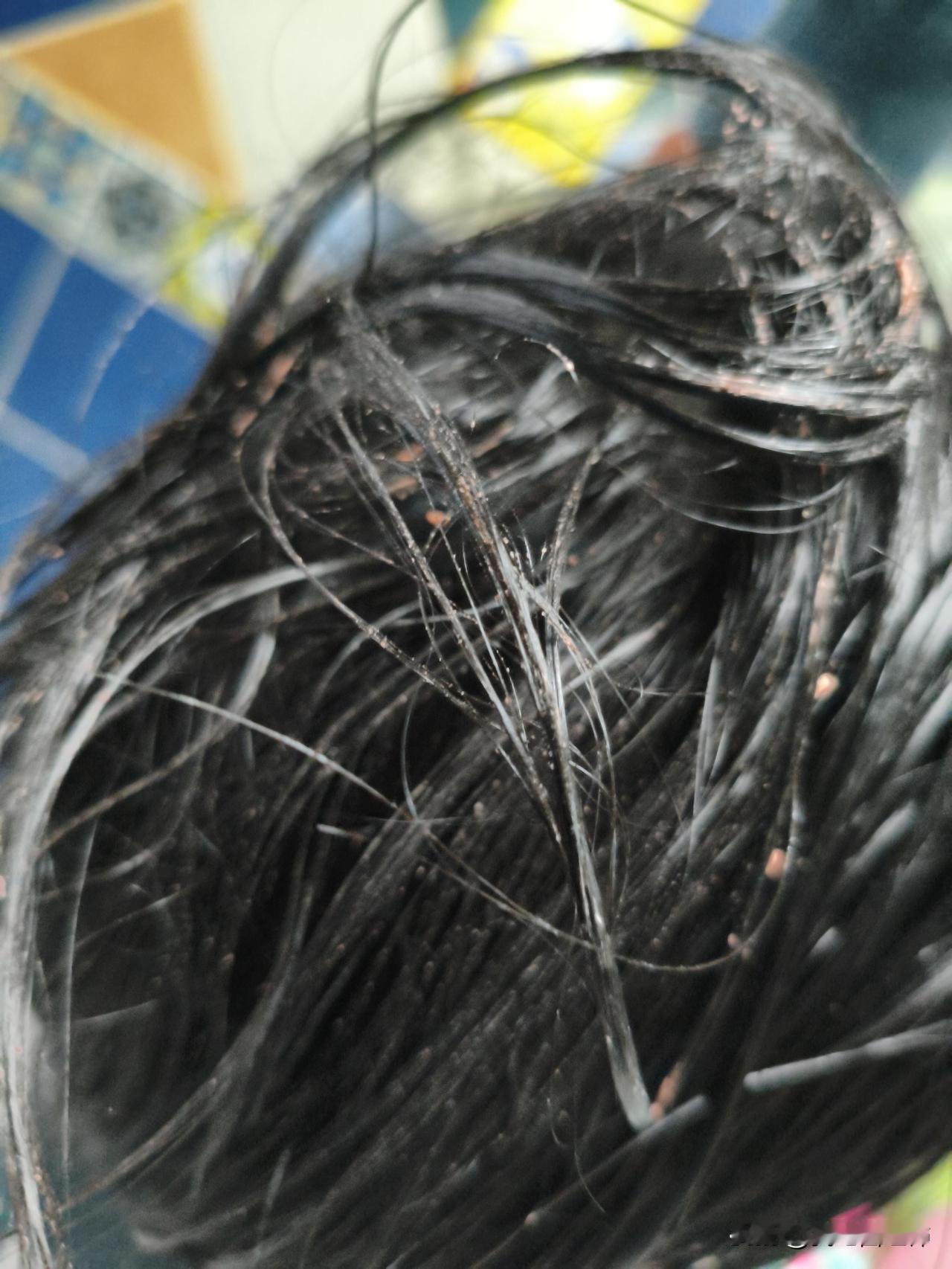 当孩子在学校意外被“伤害”觉得自己很无力昨天放学很意外，接到一个头发湿哒哒的小