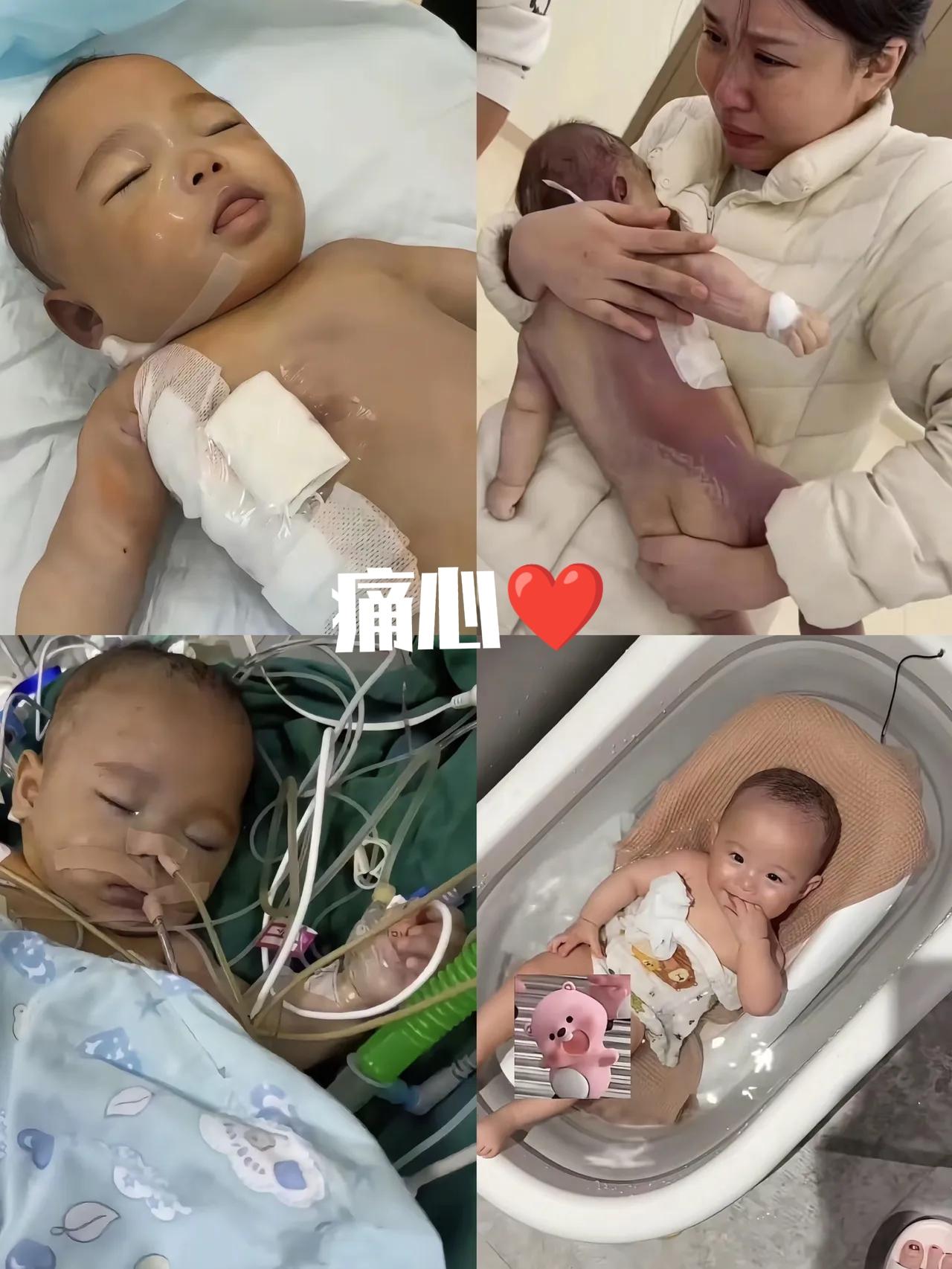 五个月宝宝微创手术！2小时变9小时？孩子脸都紫了，护士还在抱怨没饭吃？当妈的