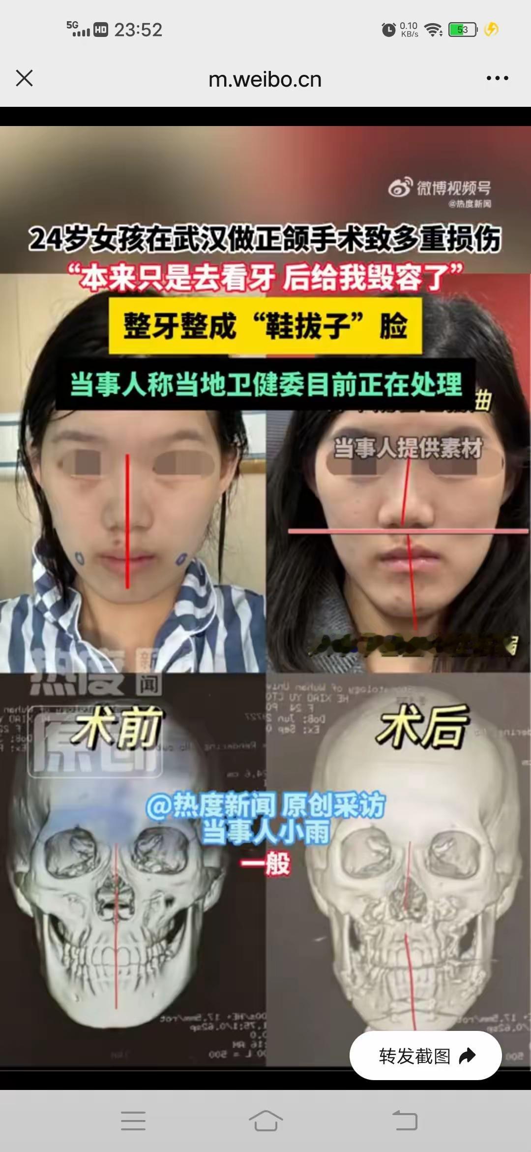 武汉那个小雨姑娘，真是倒了血霉，本来就想补个牙种个牙，最多正畸一下，结果武大口腔