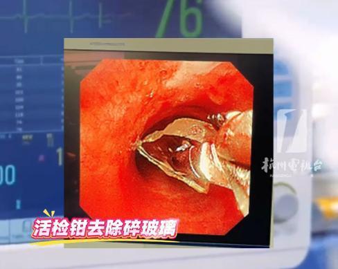 “这下解释不清了！”近日，浙江杭州，一小伙着凉后，连续咳嗽了2天，结果突然晕了过