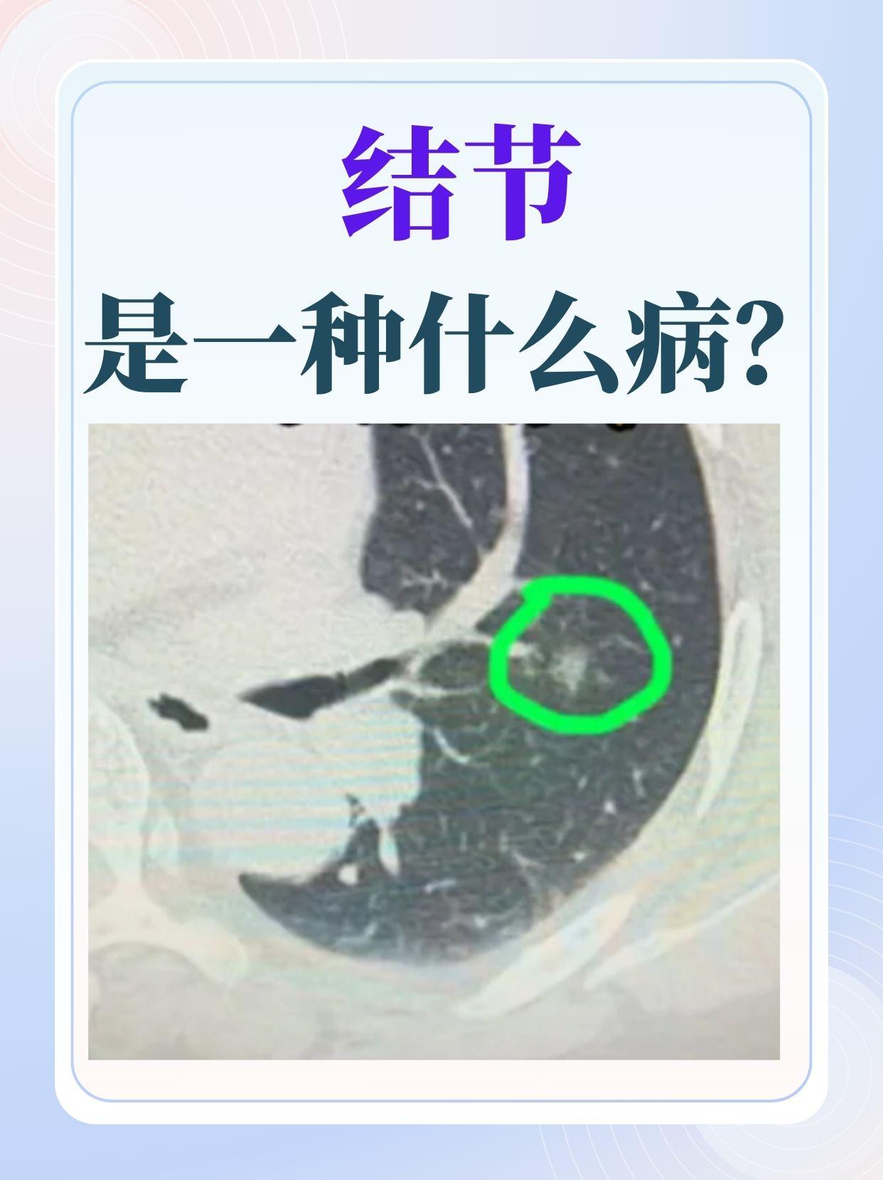 近日，河南省肿瘤医院，超声介入门诊接诊了一位19岁的女孩，就诊时对方表示胸口疼