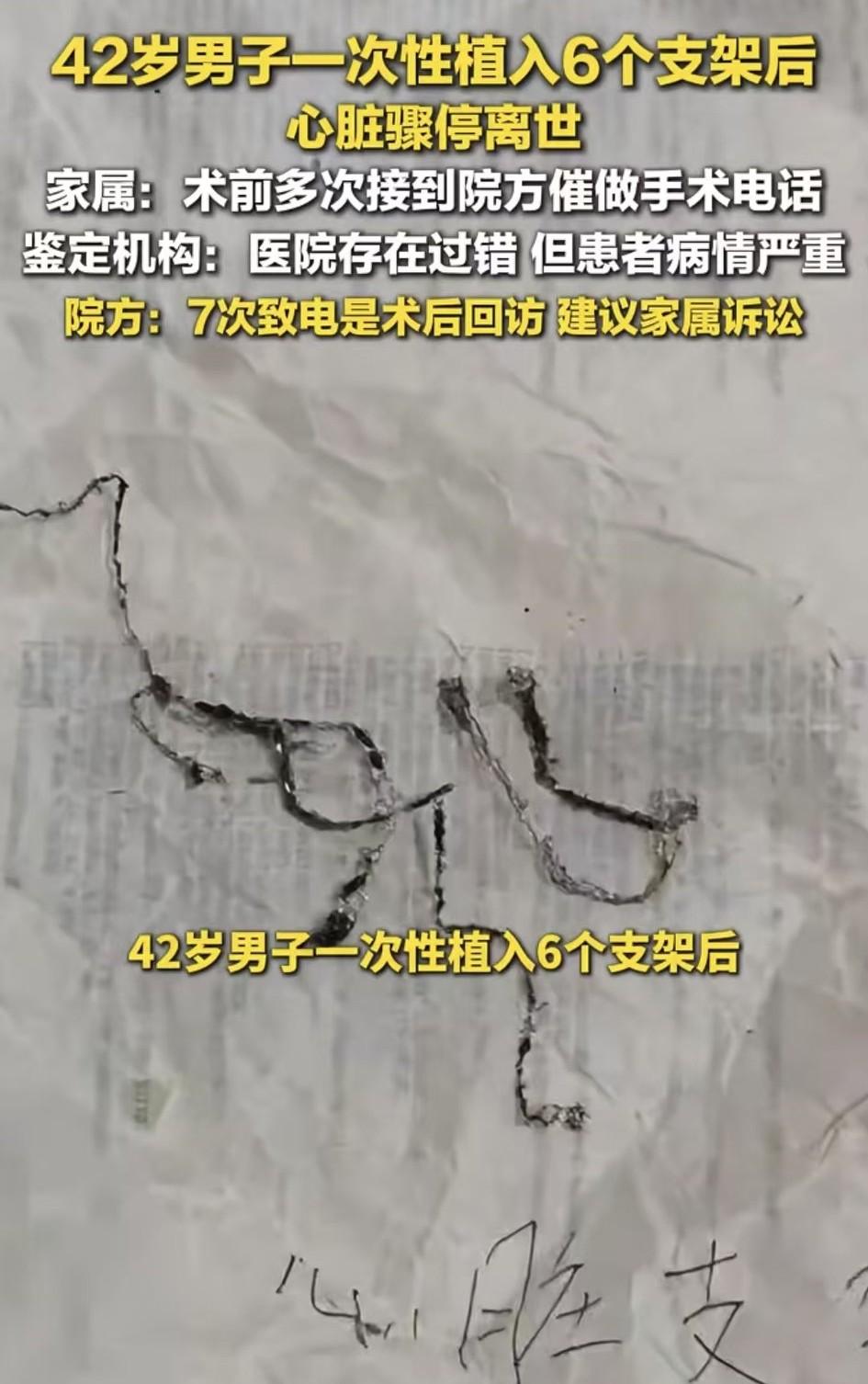 一次性植入6个支架！为啥不搭桥呢？有个朋友心梗，需要植入4个支架，一开始只植入