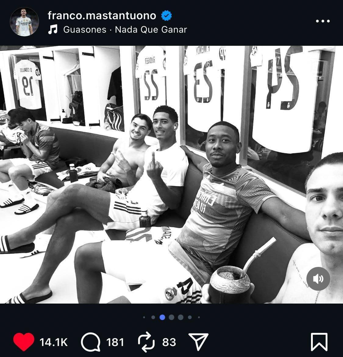 在马斯坦托诺的镜头里🖕