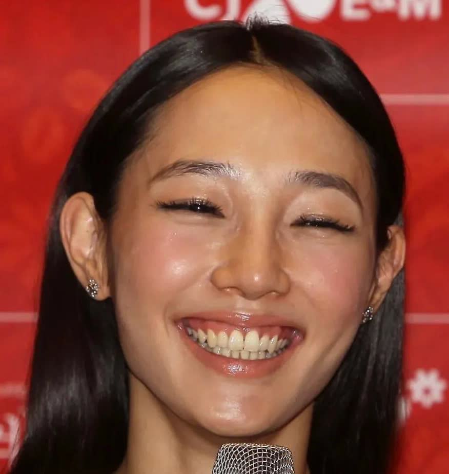 她这是有牙龈萎缩吗？这个牙床子怎么能露出来这么多？这么长的牙齿，笑起来还露牙龈，