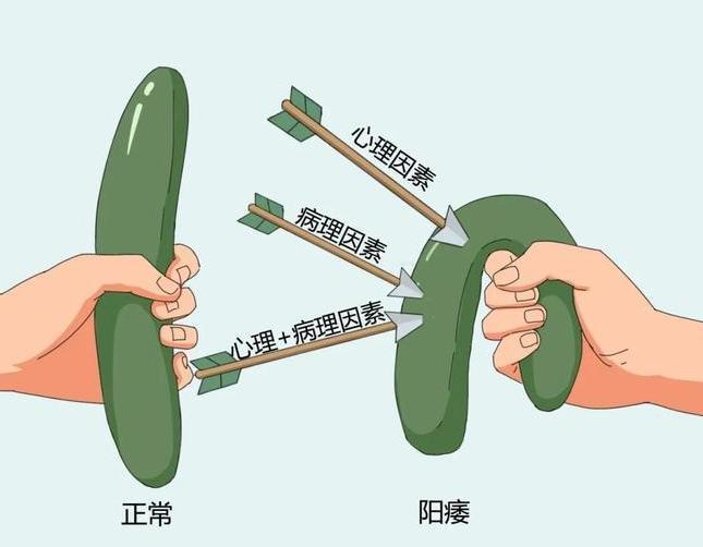 医生科普：次数越多能力越差？ED和次数究竟有无关联？老王今年45岁，是一家公