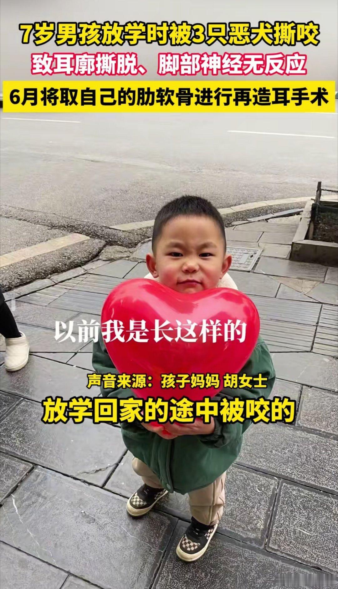 7岁男孩被3只恶犬撕咬一年后近况我最害怕狗追着我叫了，老凶了，哎，那么小的孩子，