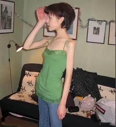 河南一90后女子为减肥辟谷，半个月不吃饭、只喝水，一个月瘦了40斤，代价是什么？