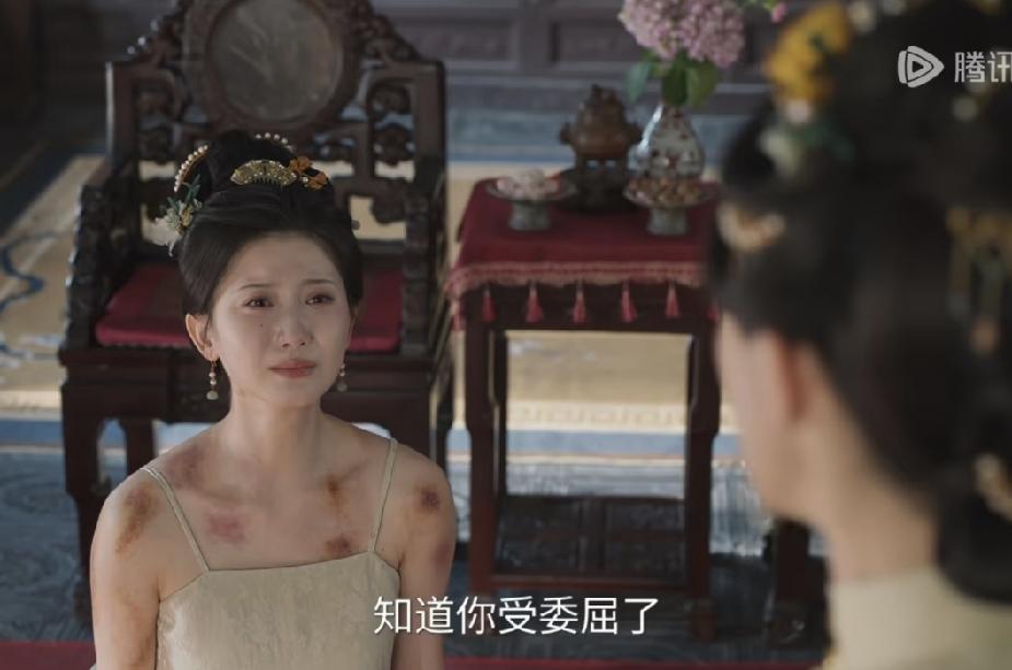 明代的嫡庶待遇真不同。林绣莱作为林家庶女，她丈夫都把她打成这样了，她还给她丈夫