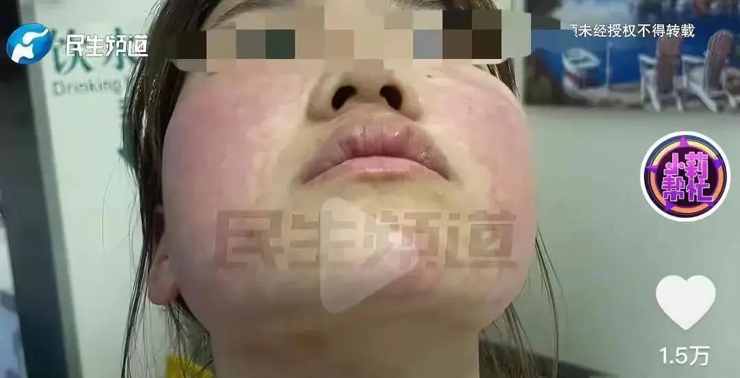 太可怕了！河南18岁女孩注射了一剂价值199元的水光针，店长告诉她这一针就能让脸