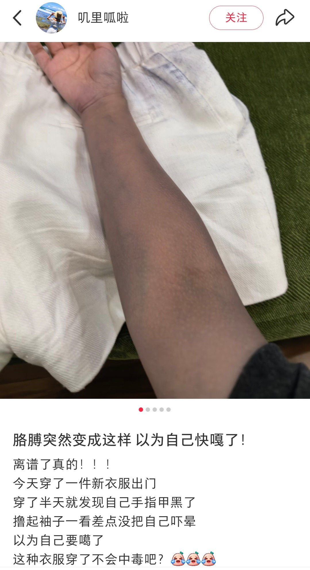 这贴主衣服掉色掉的以为自己要嘎了[笑着哭]​​​