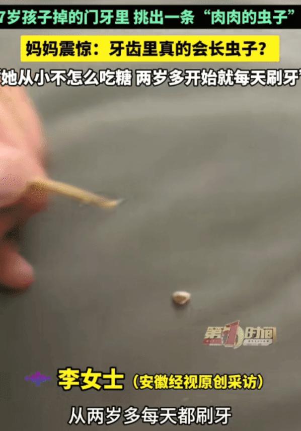 “太震惊了！”河南商丘，7岁孩子掉的门牙里，没想到，藏着“肉虫子”？孩子的妈妈挑