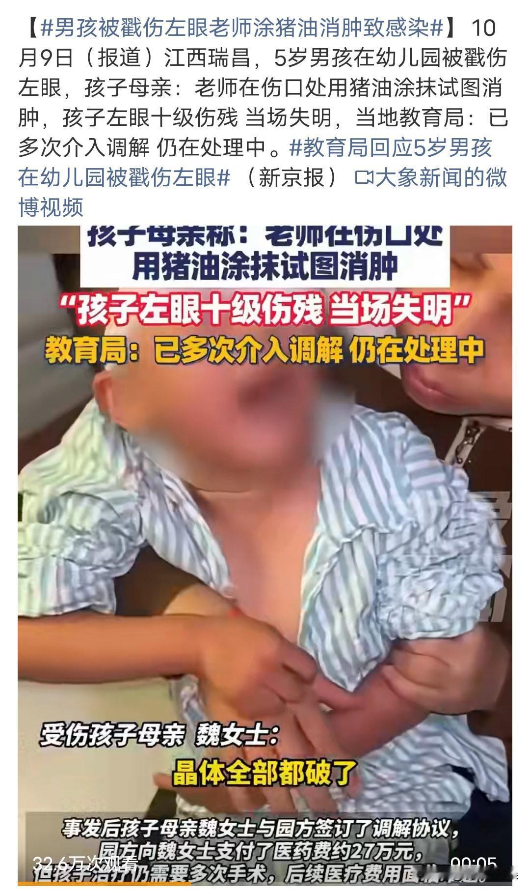 这都是些什么操作啊?话说眼镜被戳伤了,第一时间应该是送医院治疗啊,怎么会拿猪油