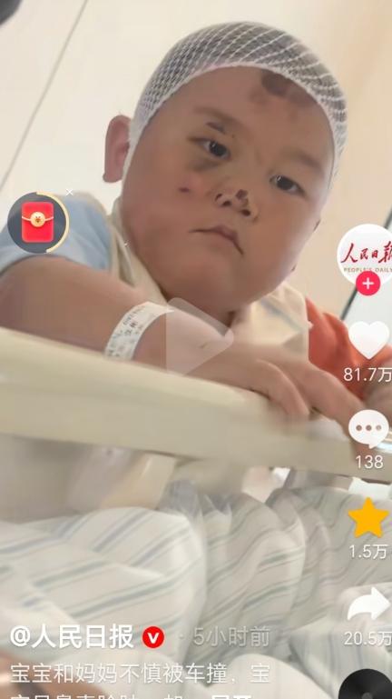 全网破防！鼻青脸肿的宝宝上人民日报了，孩子浑身带伤、明明受尽疼痛，却全程安静懂事