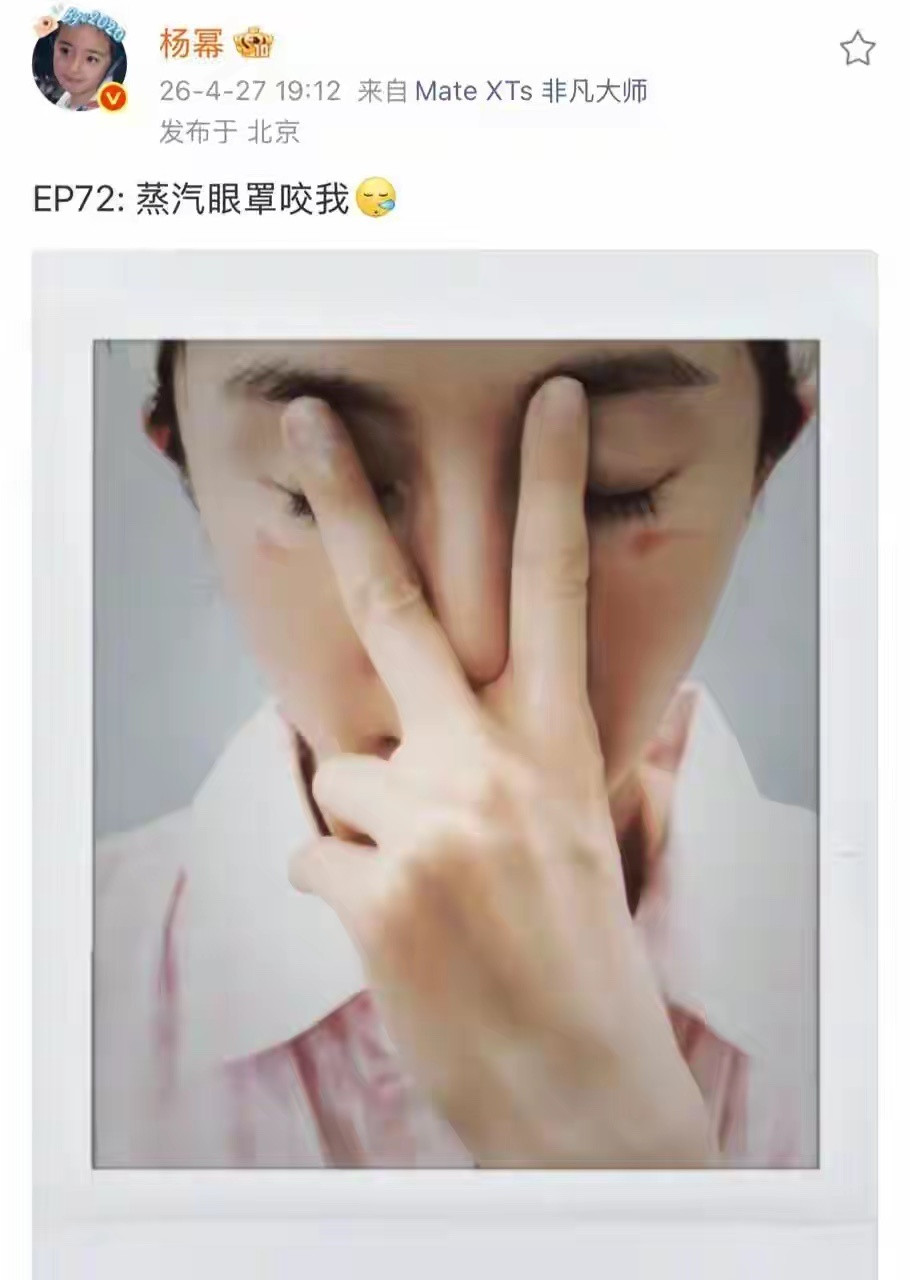 杨幂晒烫伤照登上热搜，称“蒸汽眼罩咬我”；许多人习惯戴上蒸汽眼罩帮助缓解眼部疲劳