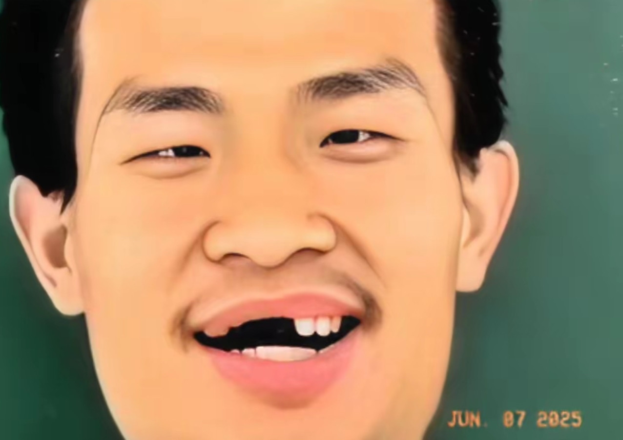 看到网上都是关于讨论韦东奕牙齿的问题很多韦神的粉丝呼吁北大医科大学给韦神检查