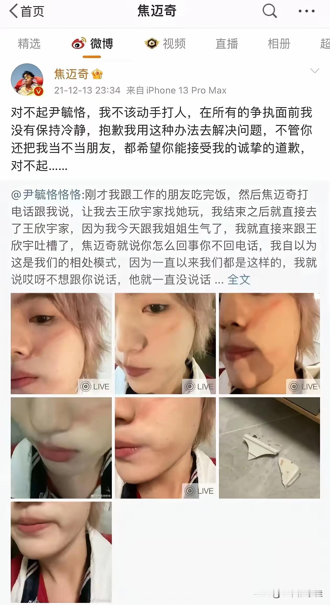 焦迈奇现在估计肠子都悔青了！他后悔的不是当年和尹毓恪动手的冲动，也不是事后道