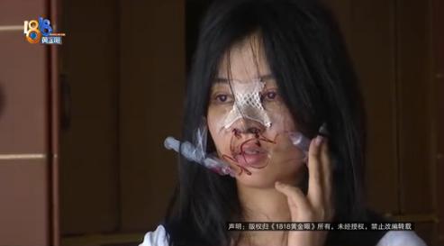 浙江杭州一女子因右手患血管瘤需20多万治疗费，去KTV面试时被告知每天小