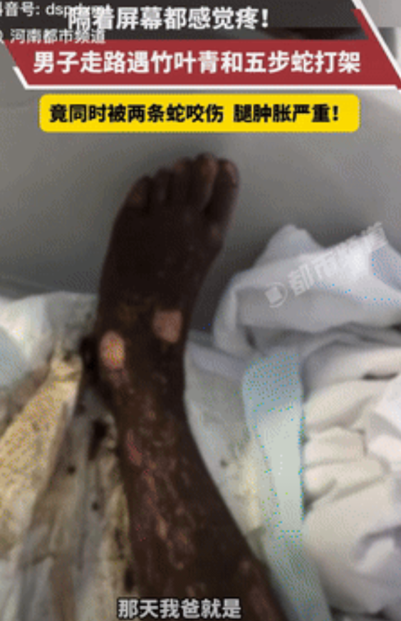 电视剧都不敢这么演！安徽，一男子傍晚散步时，偶遇竹叶青和五步蛇打架，不料，当他从