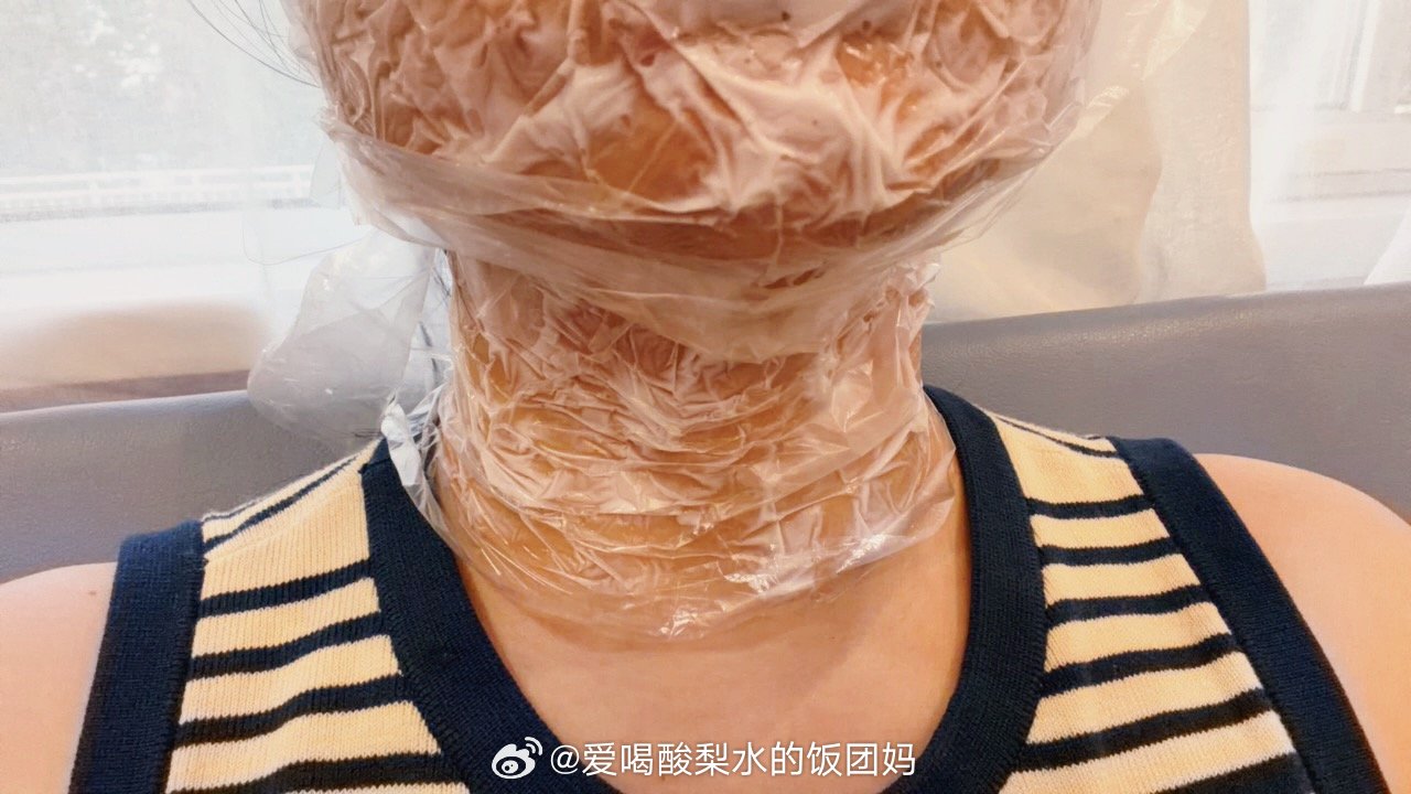 敷麻药中……好几年了这次又要搞100单位保妥适了[捂脸哭][捂脸哭][捂脸哭]上一次1